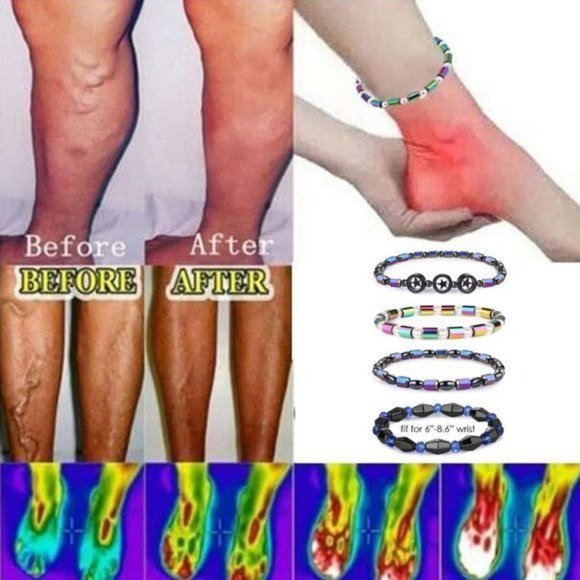 12Pcs Hematite Magnetic Bracelets Set for Men Women Magnetic Therapy Ank… - Picture 6 of 7